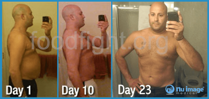 Results from using Nu Image Medical